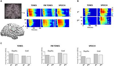 Multi-Regional Adaptation in Human Auditory Association Cortex